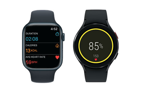 Apple Watch Samsung watch